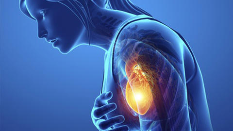 Abbildung einer Darstellung der Brustenge