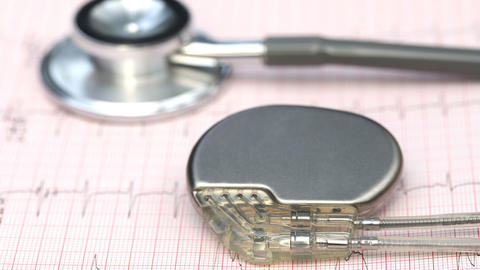 EKG und Herzschrittmacher