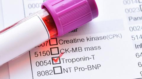 Liste mit Blutwerten